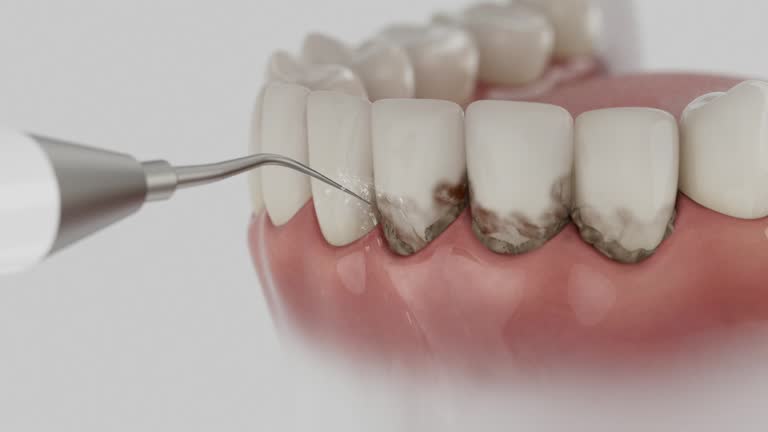 Reliable Dental contractor in Forestville, OH by Dentist Open Now